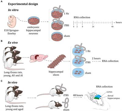 Transcriptional changes in the rat brain induced by repetitive transcranial magnetic stimulation